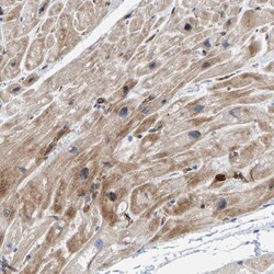 POLG2 Antibody, Novus Biologicals 0.1mL; Unlabeled:Antibodies, Polyclonal